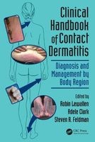 Clinical Handbook of Contact Dermatitis - Diagnosis and Management by Body Region (Paperback) - Robin Lewallen Photo
