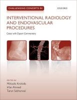 Challenging Concepts in Interventional Radiology (Paperback) - Miltiadis Krokidis Photo
