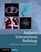 Pediatric Interventional Radiology (Hardcover) - Richard Towbin Photo