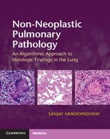 Non-Neoplastic Pulmonary Pathology with Online Resource - An Algorithmic Approach to Histologic Findings in the Lung (Hardcover) - Sanjay Mukhopadhyay Photo