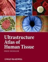 Ultrastructure Atlas of Human Tissues (Hardcover) - Fred Hossler Photo