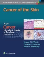 Cancer of the Skin - Cancer: Principles & Practice of Oncology (Paperback, 10th Revised edition) - Vincent T DeVita Photo