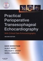 Practical Perioperative Transesophageal Echocardiography (Paperback, 2nd Revised edition) - David Sidebotham Photo