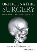 Orthognathic Surgery - Principles, Planning and Practice (Hardcover) - Farhad B Naini Photo