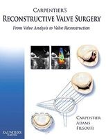 Carpentier's Reconstructive Valve Surgery (Hardcover) - David H Adams Photo