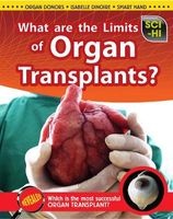 What Are the Limits of Organ Transplantation? (Hardcover) - Anna Claybourne Photo
