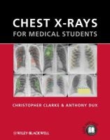 Chest X-Rays for Medical Students (Paperback, New) - Christopher Clarke Photo