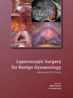 Laparoscopic Surgery for Benign Gynaecology Hardback with DVDs - Advanced Skills Series (Hardcover, New) - Alfred Cutner Photo