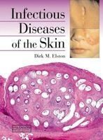 Infectious Diseases of the Skin (Paperback) - Dirk M Elston Photo
