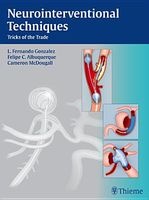 Neurointerventional Techniques: Tricks of the Trade (Hardcover) - Fernando Leon Gonzalez Photo