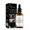 Anti- Hair Loss Oil x 30g Photo