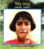 My oog : Grade R Grade 1 : Vlak 1: Leesboek Photo