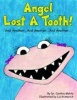 Angel Lost a Tooth! Photo